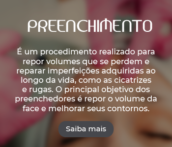 Botao 350x300 Preenchimento