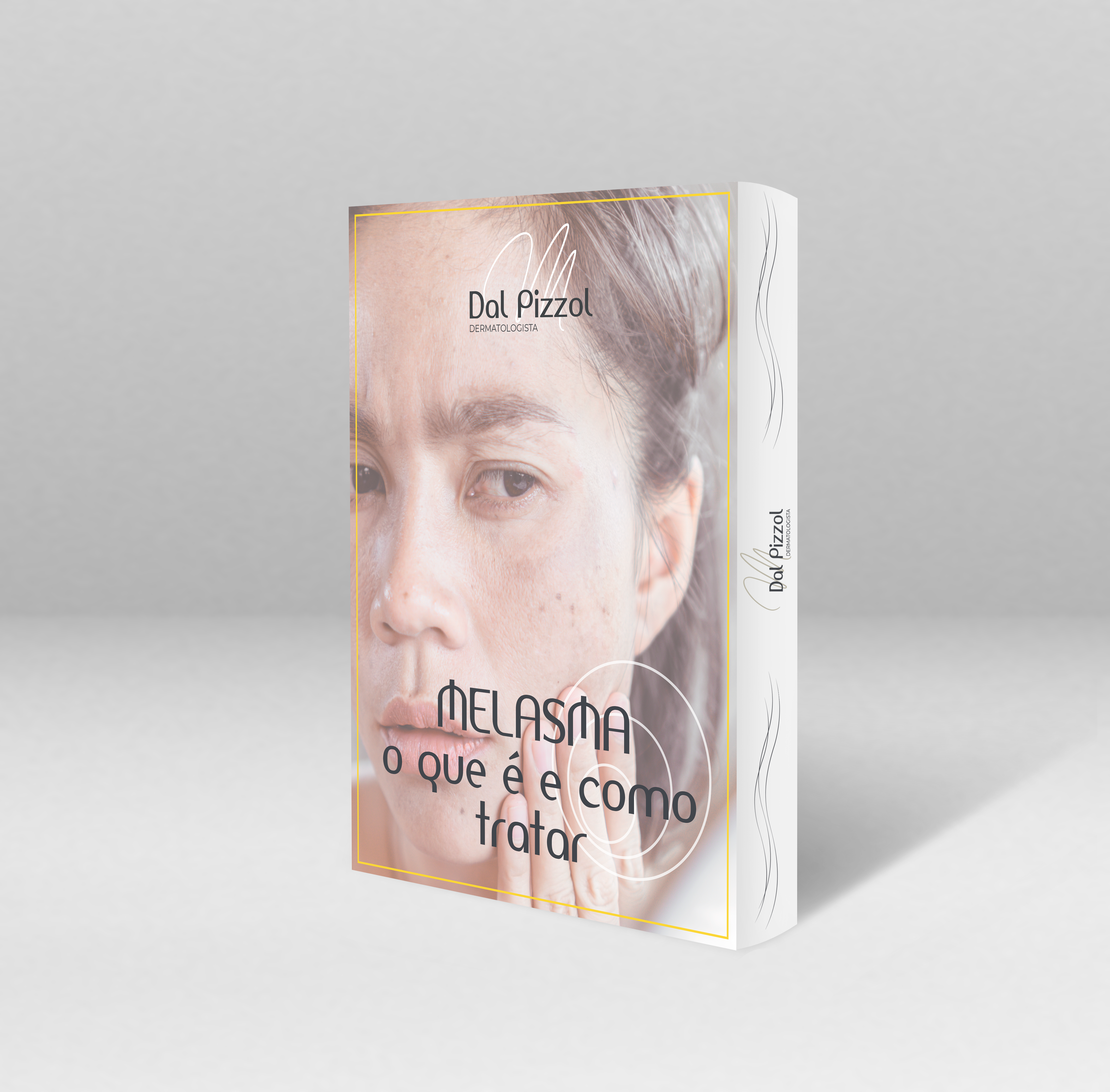 Ebook Melasma